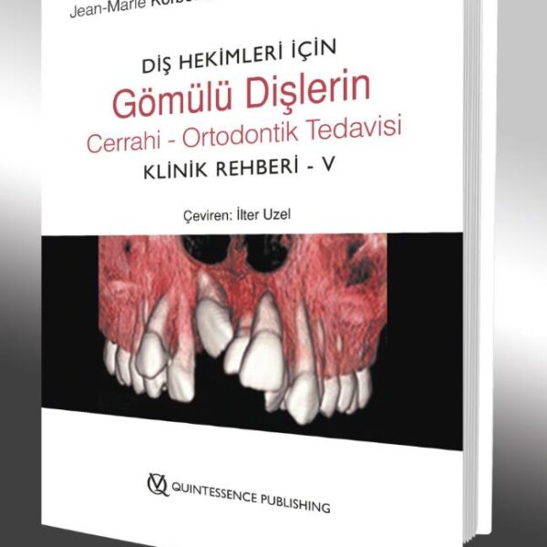 Diş Hekimleri İçin Gömülü Dişlerin Cerrahi - Ortodontik Tedavisi Klinik Rehberi - V