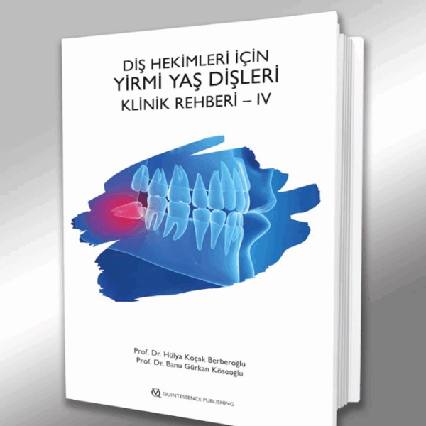 DİŞ HEKİMLERİ İÇİN YİRMİ YAŞ DİŞLERİ KLİNİK REHBERİ – IV