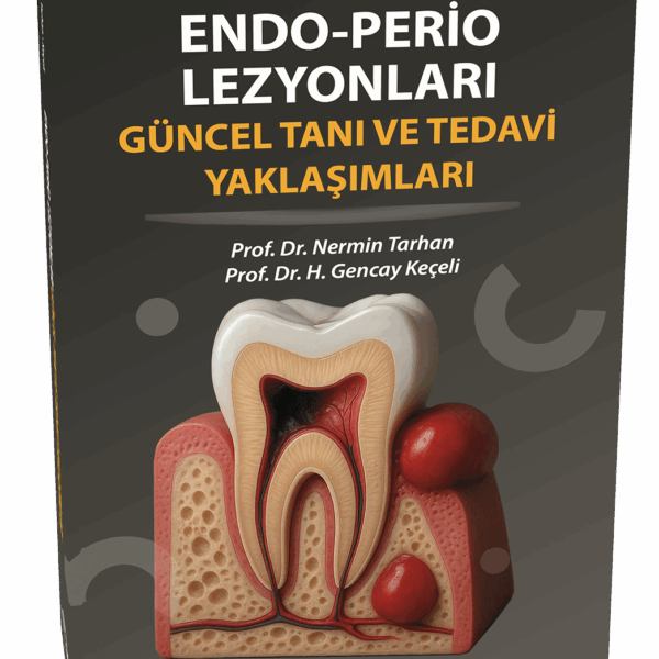 Endo - Perio Lezyonları Güncel Tanı ve Tedavi Yaklaşımları