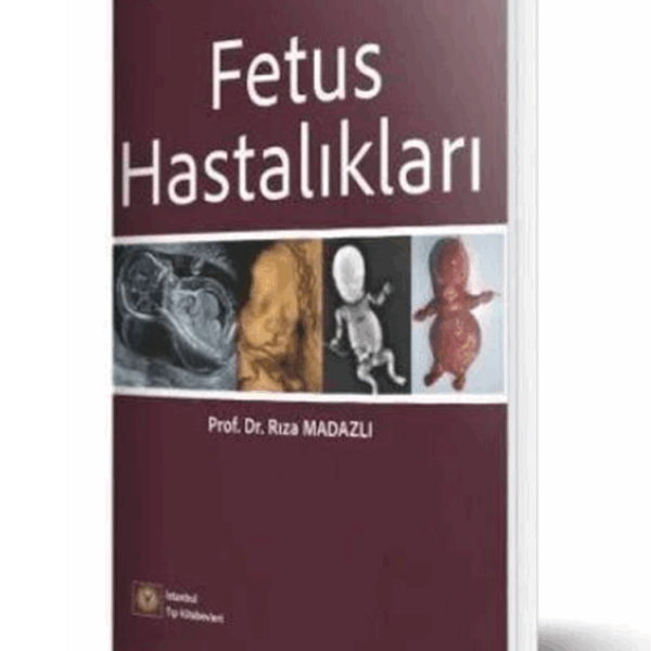 Fetus Hastalıkları