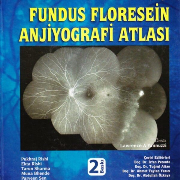 Fundus Floresein Anjiyografi Atlası