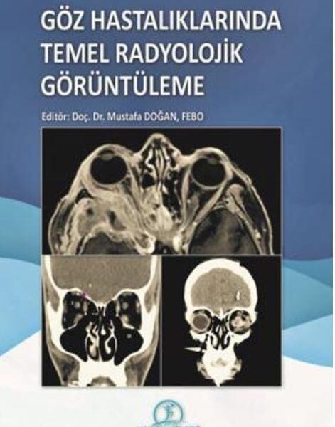 Göz Hastalıklarında Temel Radyolojik Görüntüleme