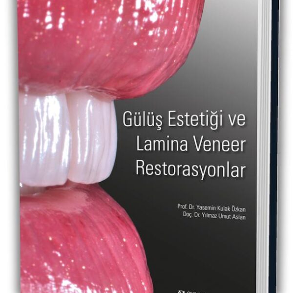 Gülüş Estetiği ve Lamina Veneer Restorasyonlar