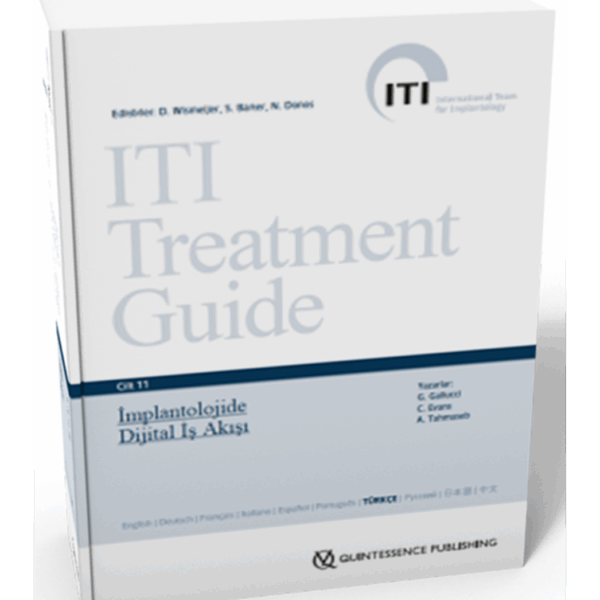 ITI Treatment Guide VOL 11 - İmplantolojide Dijital İş Akışı