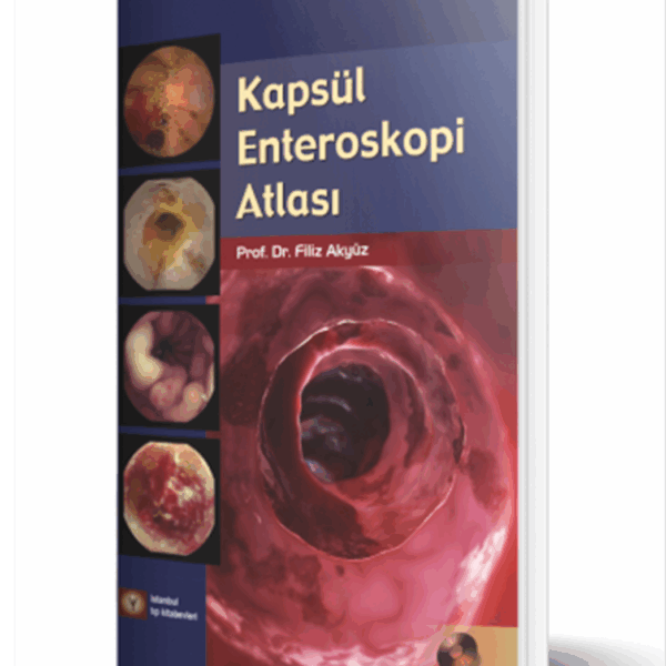 Kapsül Enteroskopi Atlası