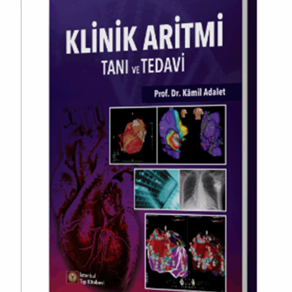 Klinik Aritmi Tanı ve Tedavi