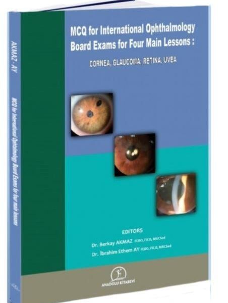 MCQ for Internatıonal Board Exams ın Four Maın Lessons: CORNEA, GLAUCOMA, RETINA