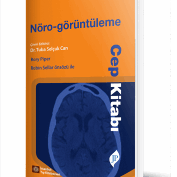 Nöro-görüntüleme Cep Kitabı