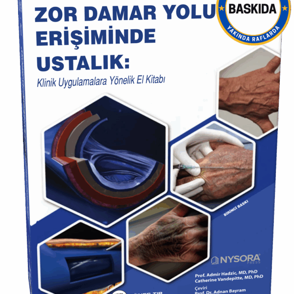 NYSORA - Zor Damar Yolu Erişiminde Ustalık: Klinik Uygulamalara Yönelik El Kitabı