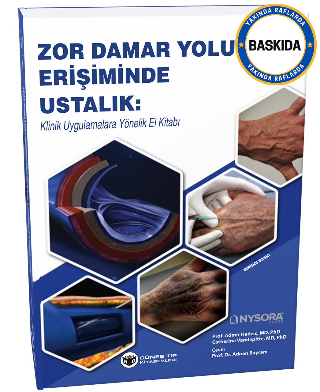nysora-zor-damar-yolu-erisiminde-ustal-f-bd03.png
