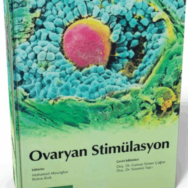 Ovaryan Stimülasyon