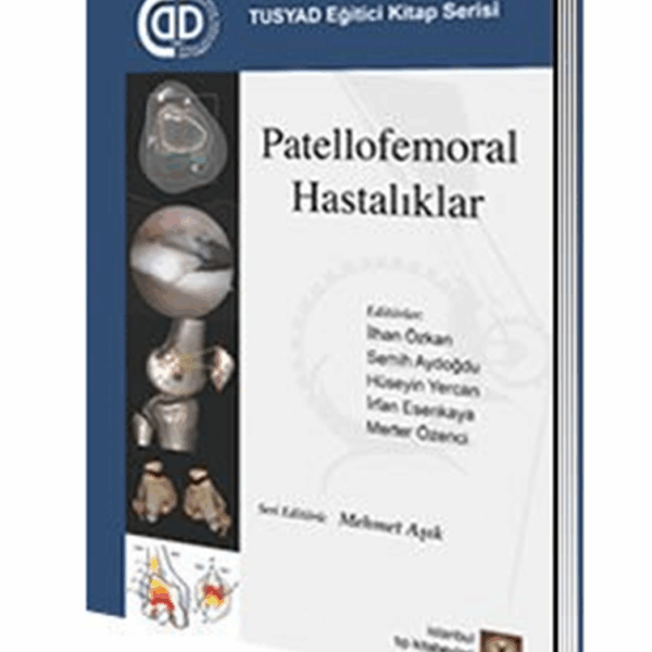 Patellofemoral Hastalıklar