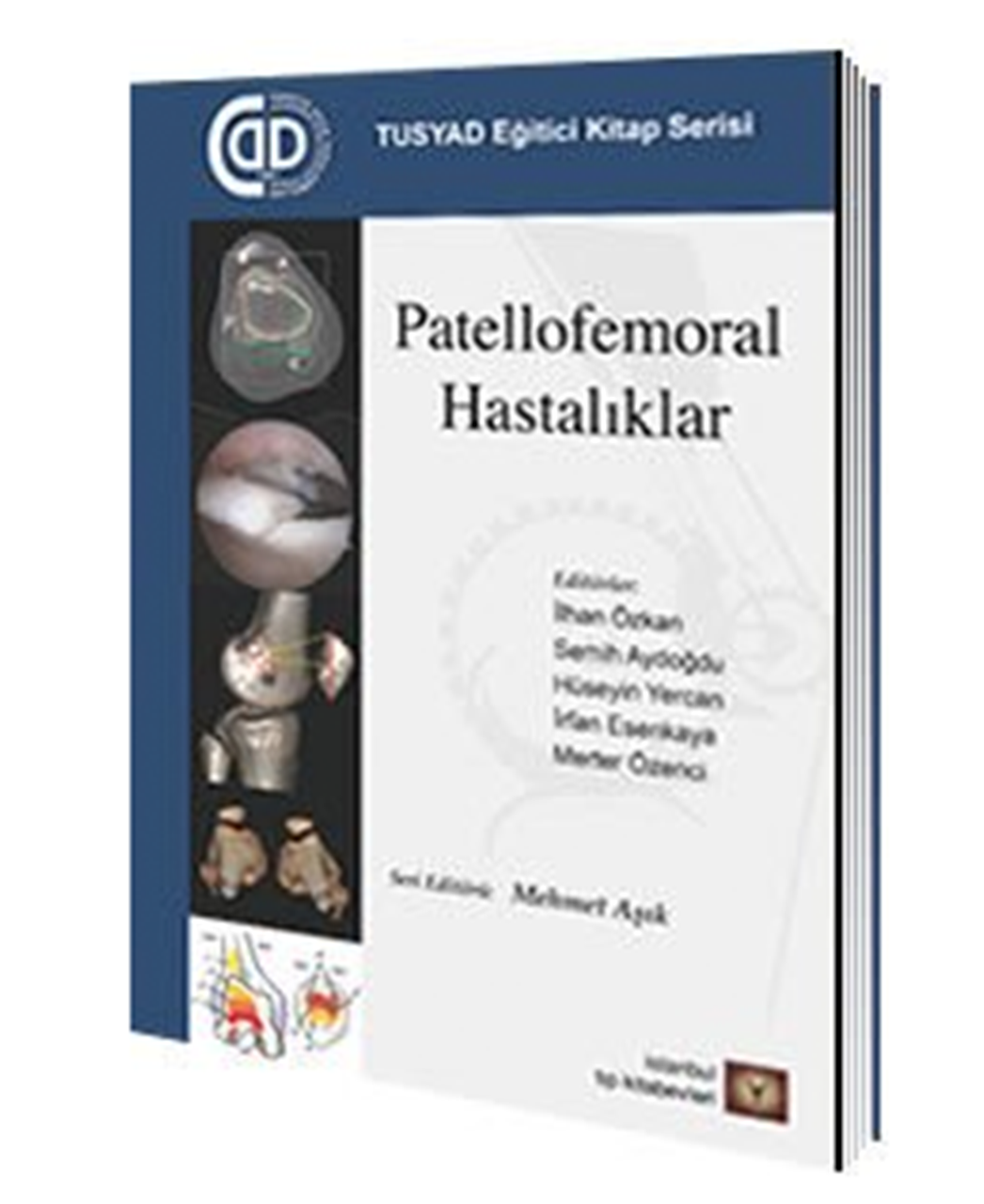 patellofemoral-hastaliklar-d2199-.png