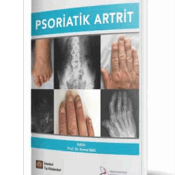 Psoriatik Artrit