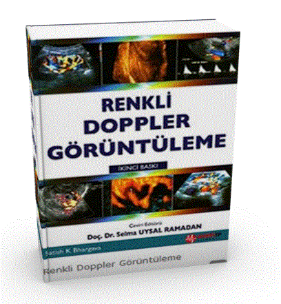 Renkli Doppler Görüntüleme
