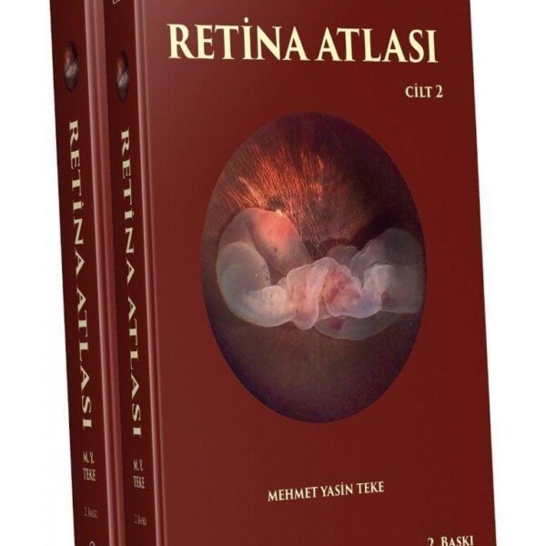 Retina Atlası (2 Cilt)