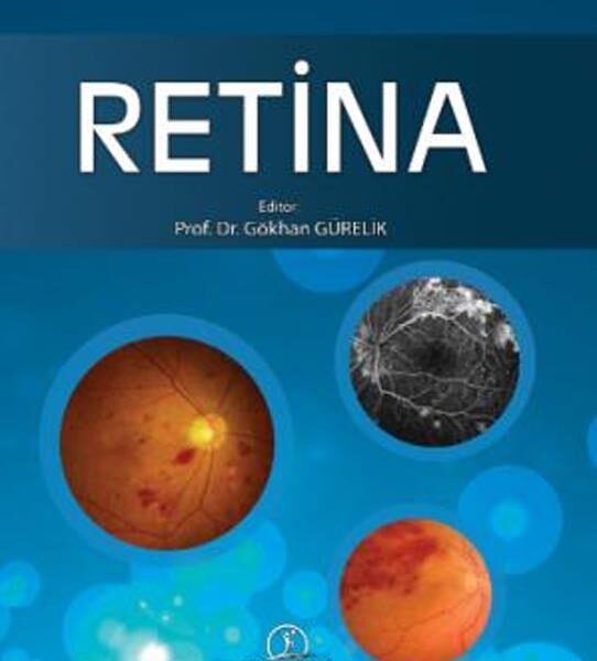 Retina ”Temel Retina  Hastalıklarına Güncel  Yaklaşımlar”