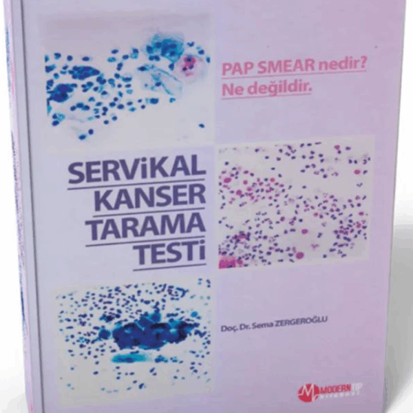 Servikal Kanser Tarama Testi