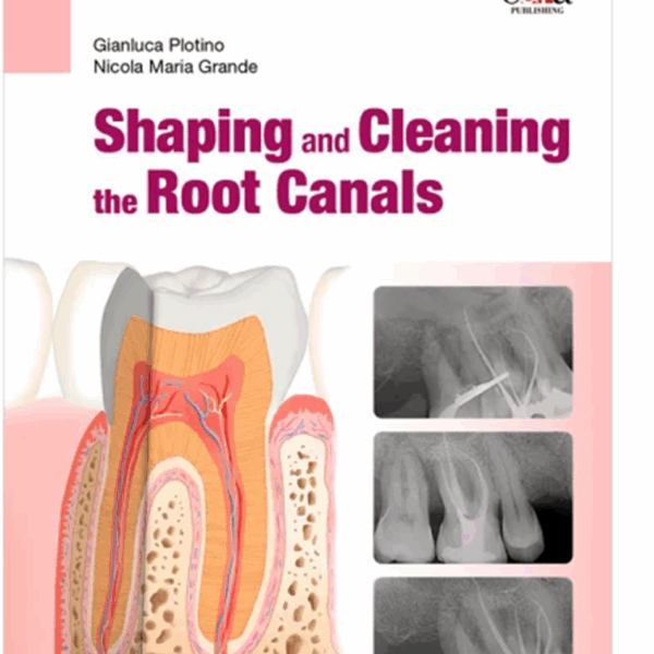 Shaping and Cleaning the Root Canals