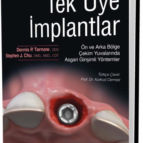 Tek üye implantlar - Ön ve Arka Bölge Çekim Yuvalarında Asgari Girişimli Yöntemler