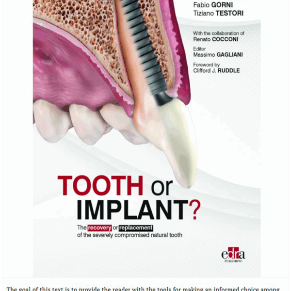 Tooth or Implant