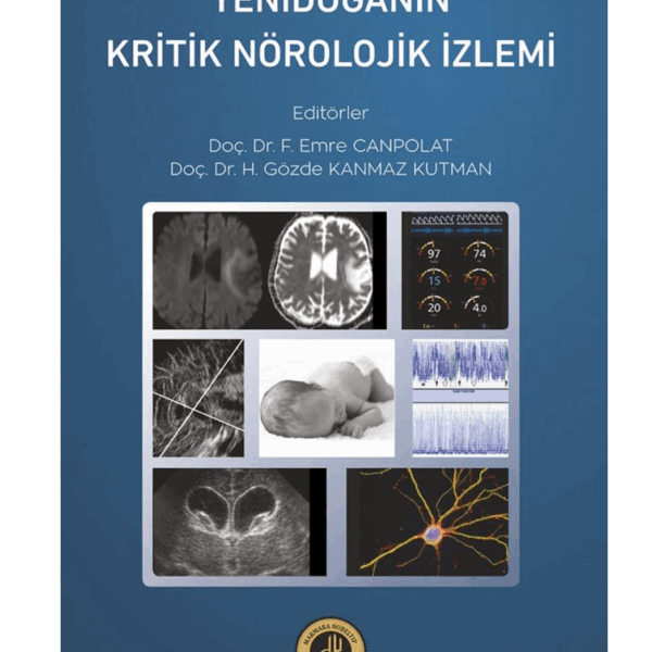 Yenidoğanın Kritik Nörolojik İzlemi